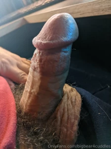 18557255