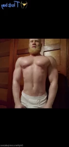 18623278