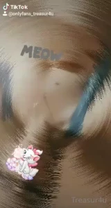 18623366