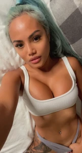 16075561